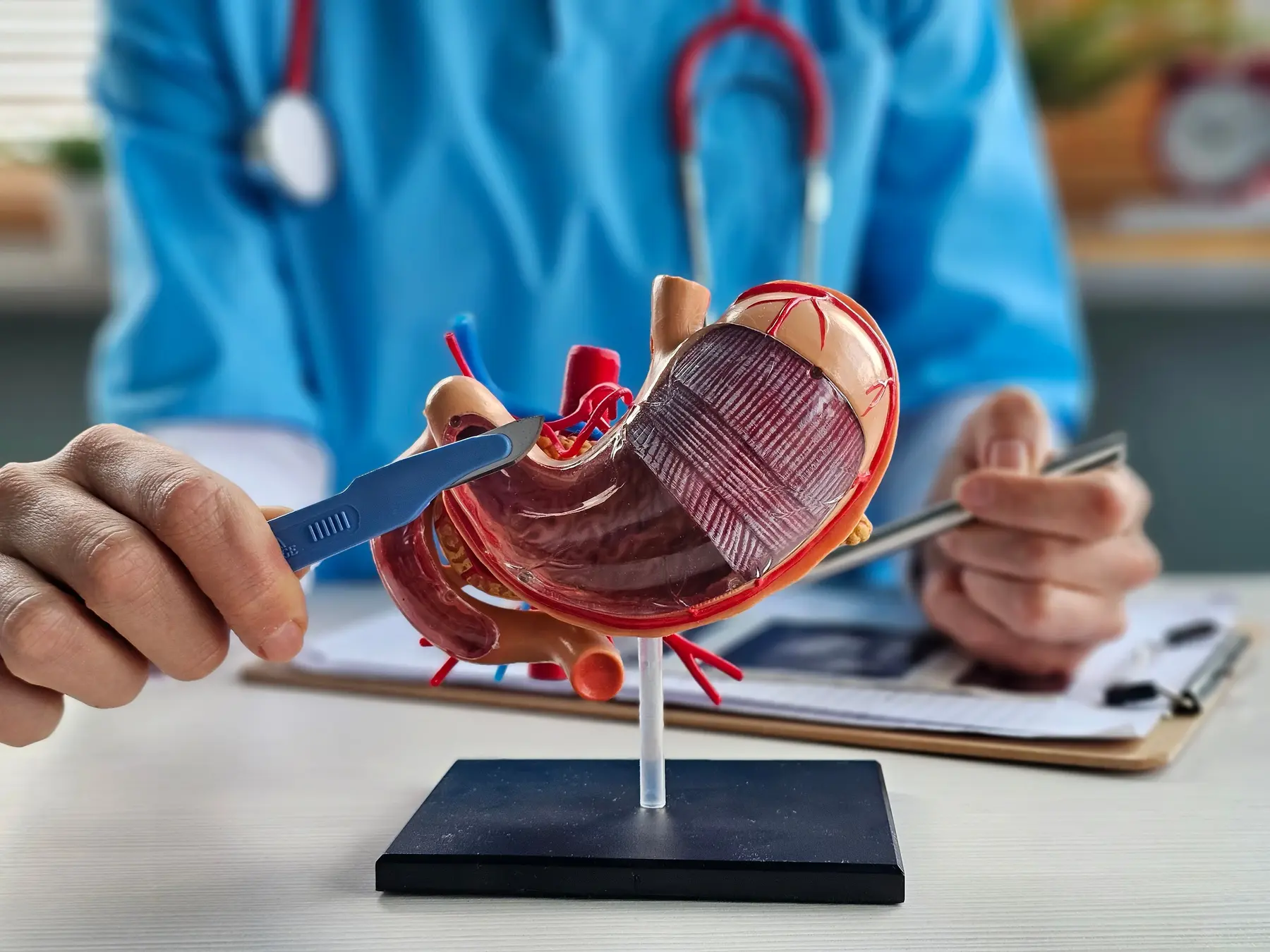 model of human stomach concept